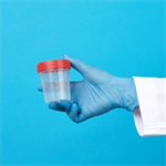 SUD Part 1: Interpreting Drug Test Results: Science & Limitations